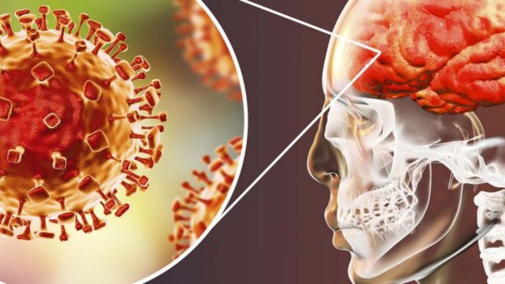 La Meningitis Causa Cada Año 300 Mil Defunciones En Todo El Mundo 4006